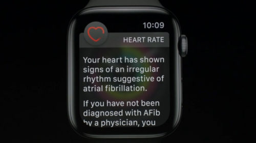 And finally: Apple Watch Series 4 detects AFib with 98% accuracy, says Heart Study