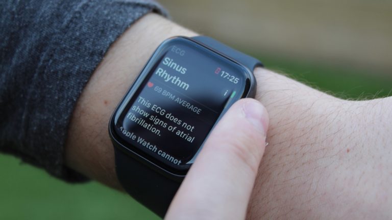 apple watch series 3 atrial fibrillation