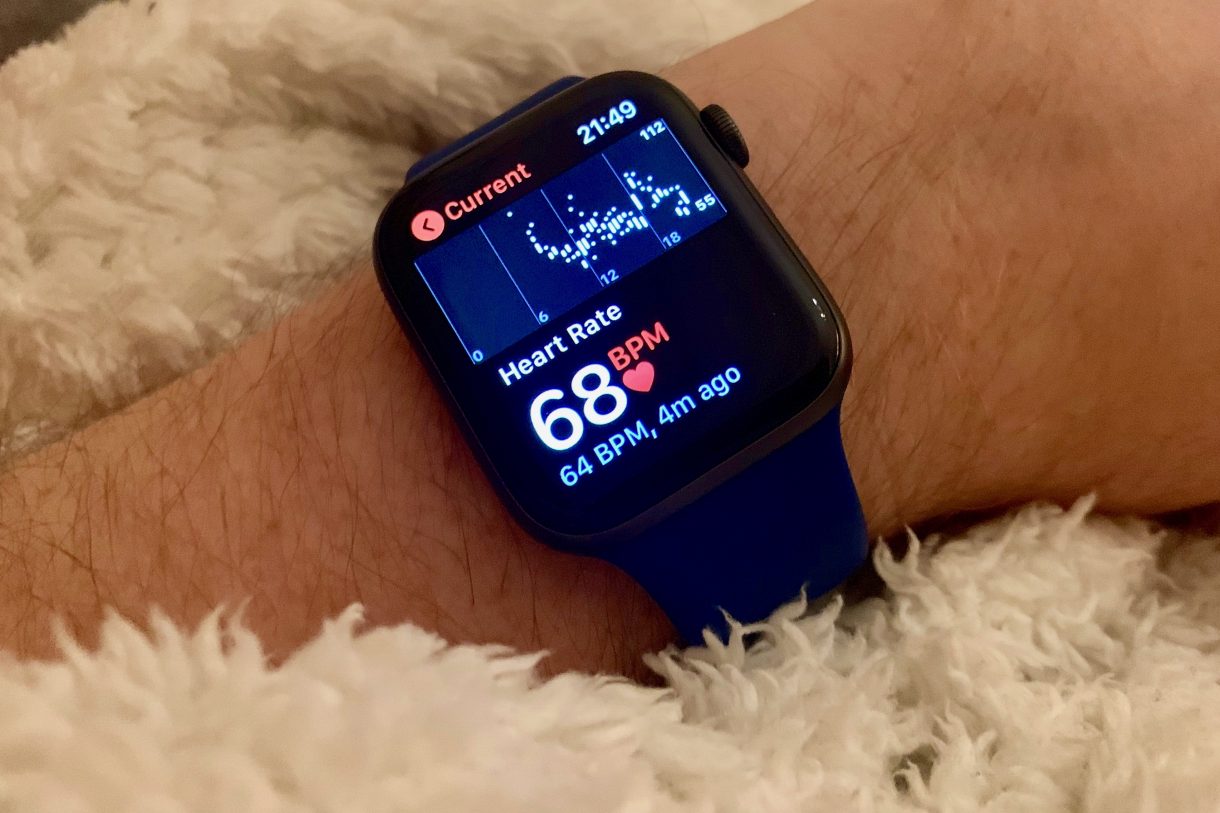 apple watchos