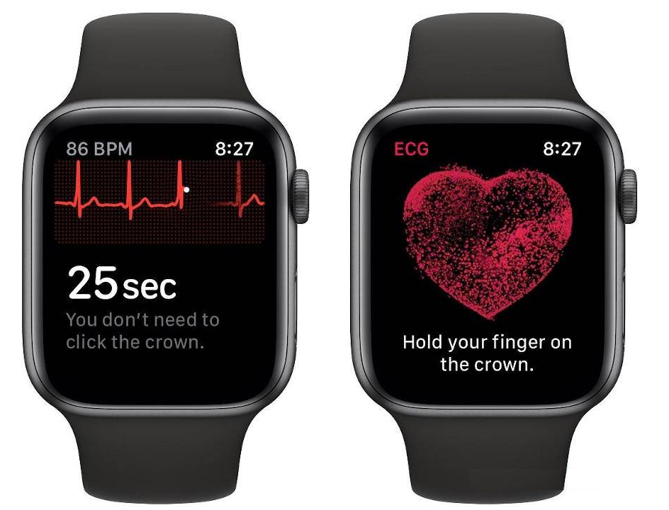iwatch heart ekg