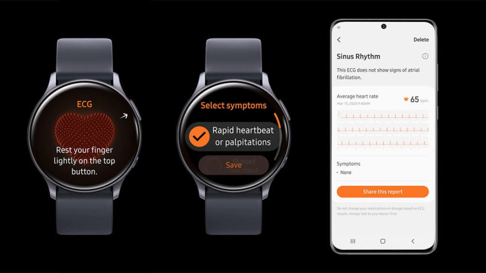 Samsung Galaxy Watch models get ECG feature