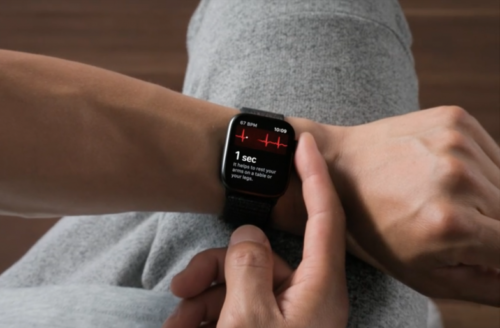 Are Apple Watch heart health features putting undue strain on NHS?