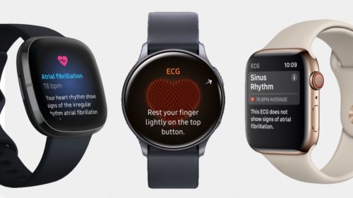 ECG smartwatches: How they work and the best on the market