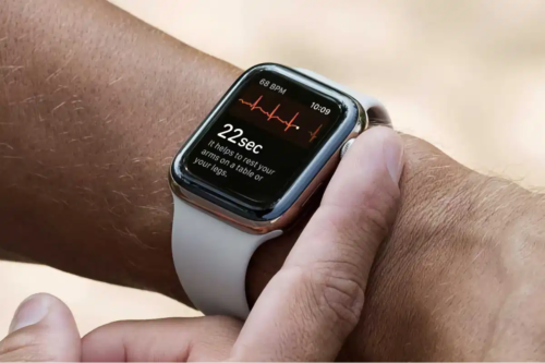 watchOS 7.6.1 update is available with a security fix