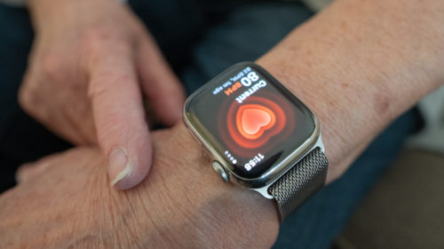 Smartwatch Wearers May Be Making A Big Health Mistake