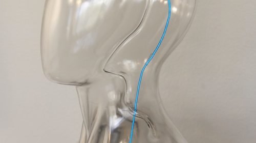 Elon Musk’s Neuralink is getting more competition
