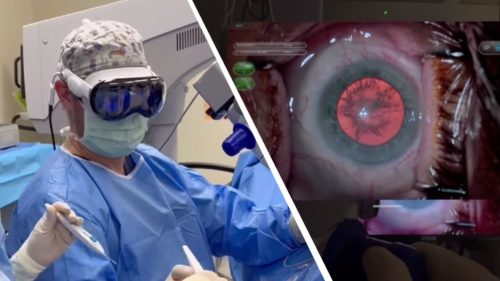 ‘Safer, smarter, and more connected’: Apple’s Vision Pro used in world-first VR-assisted surgery, and it could be the future of medicine