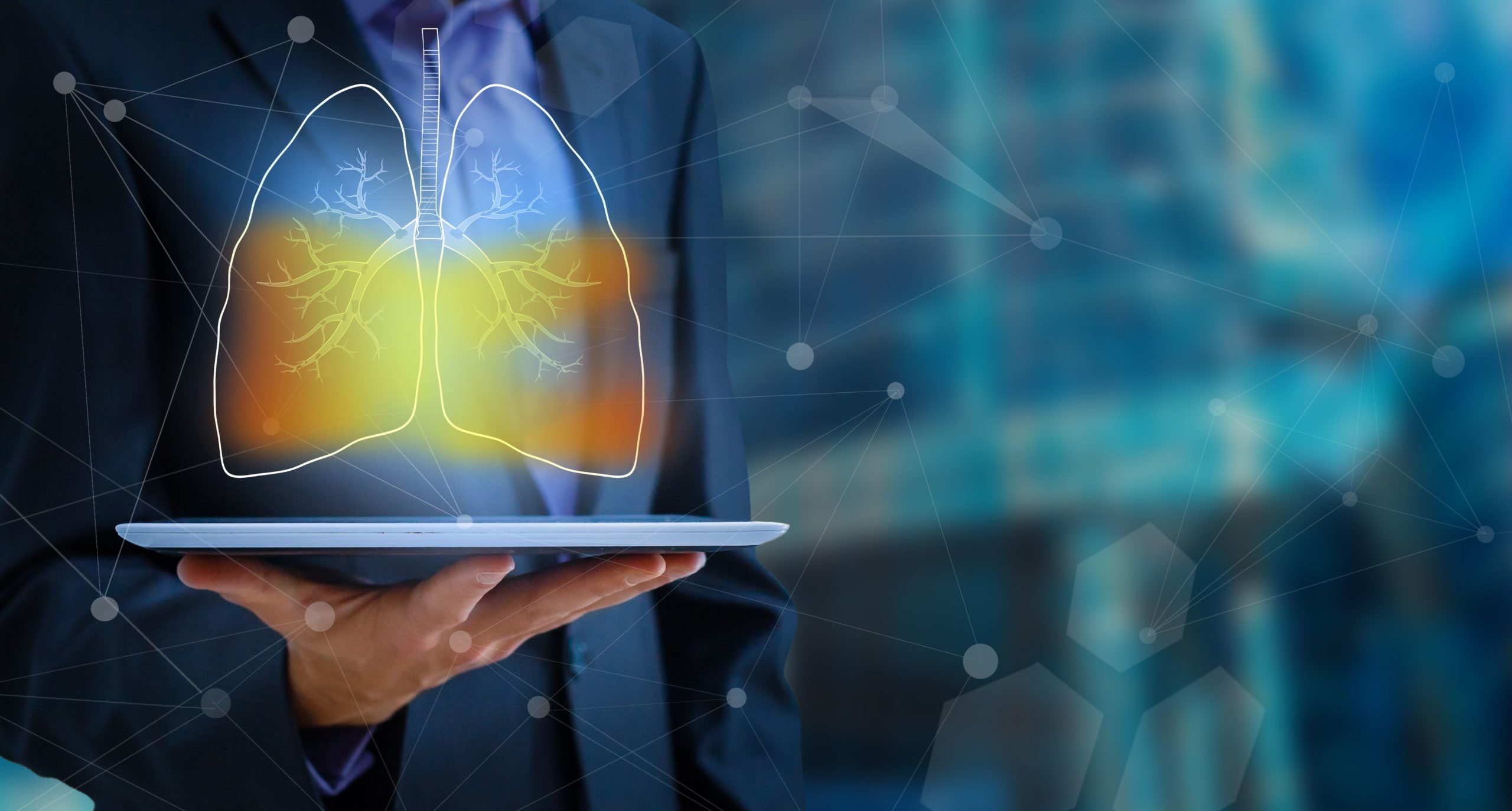 AI and MRD Take Center Stage on Day 2 of ASCO Breakthrough 2026 | CancerNetwork