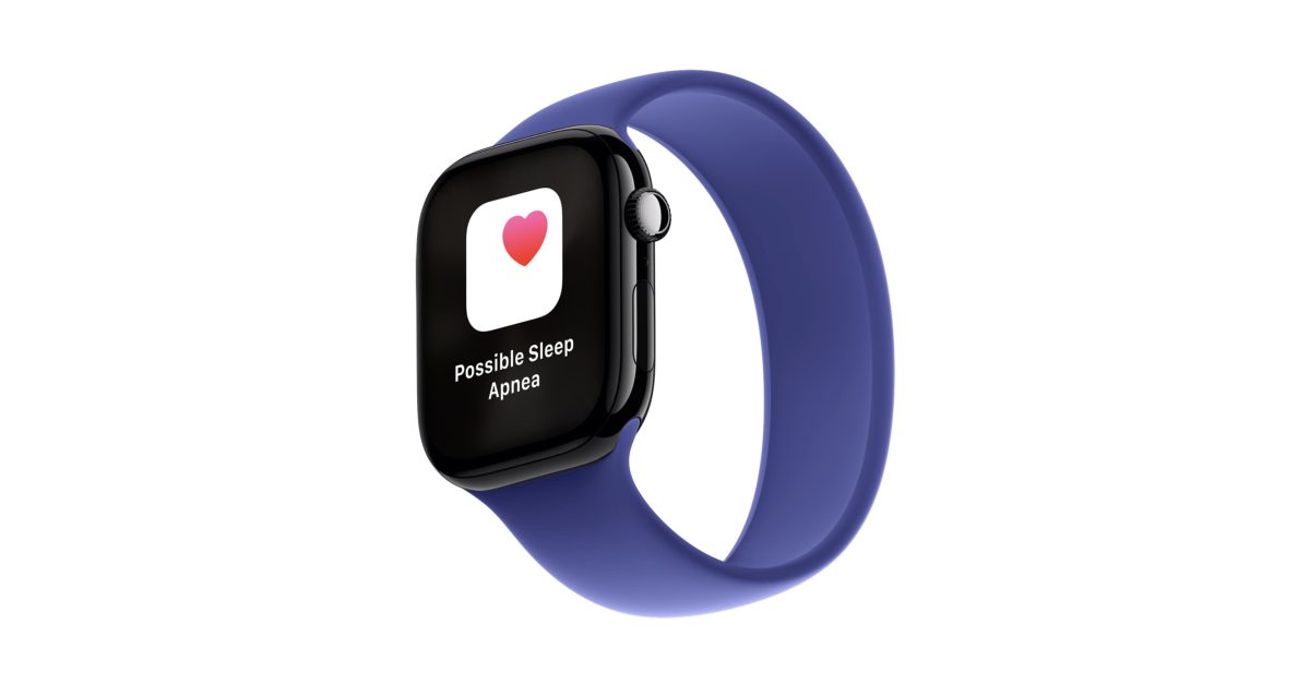 Report: Apple captured nearly all Edge AI smartwatch shipments in Q1 2026 – 9to5Mac