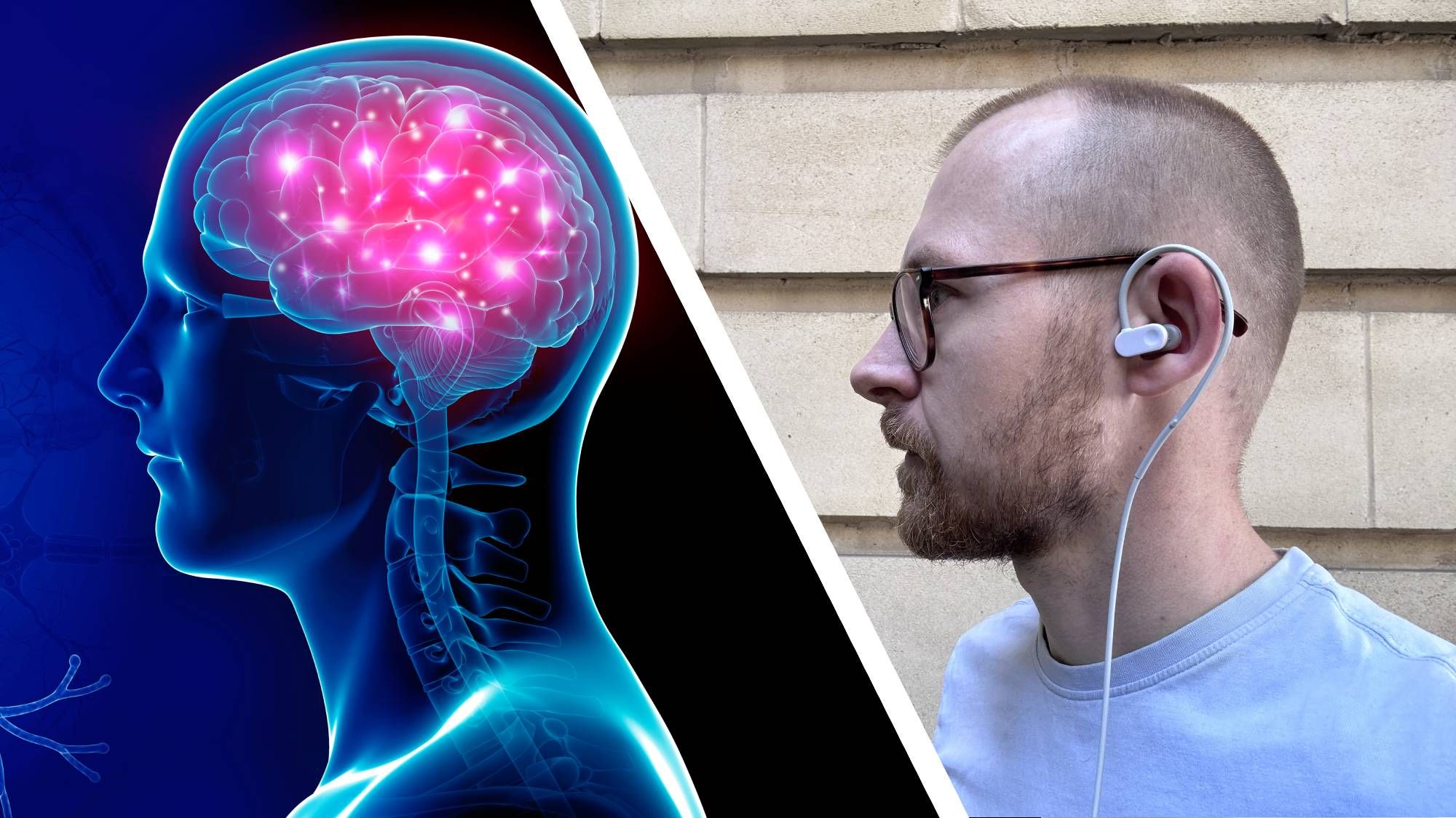 I spent a week electrocuting myself to understand the weird and wonderful world of wearable brain tech