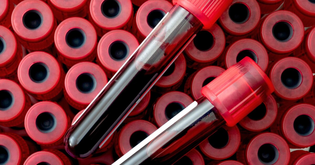 Blood test could predict dementia decades before symptoms first appear