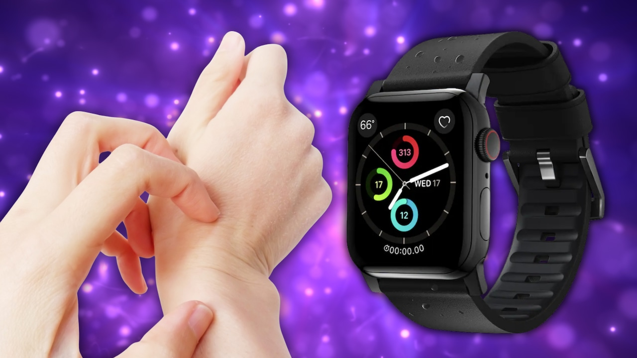 Is your Apple Watch making your wrist itch? Here’s what to do about it