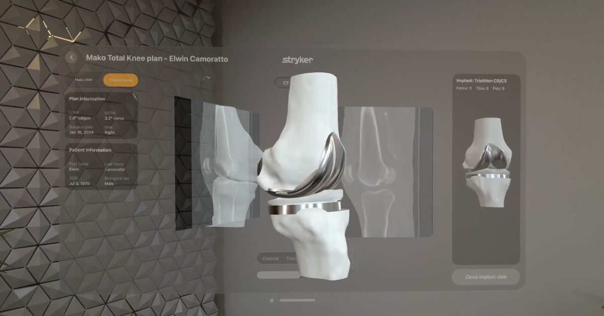 Vision Pro is a niche product, but an incredibly valuable one in the right hands
