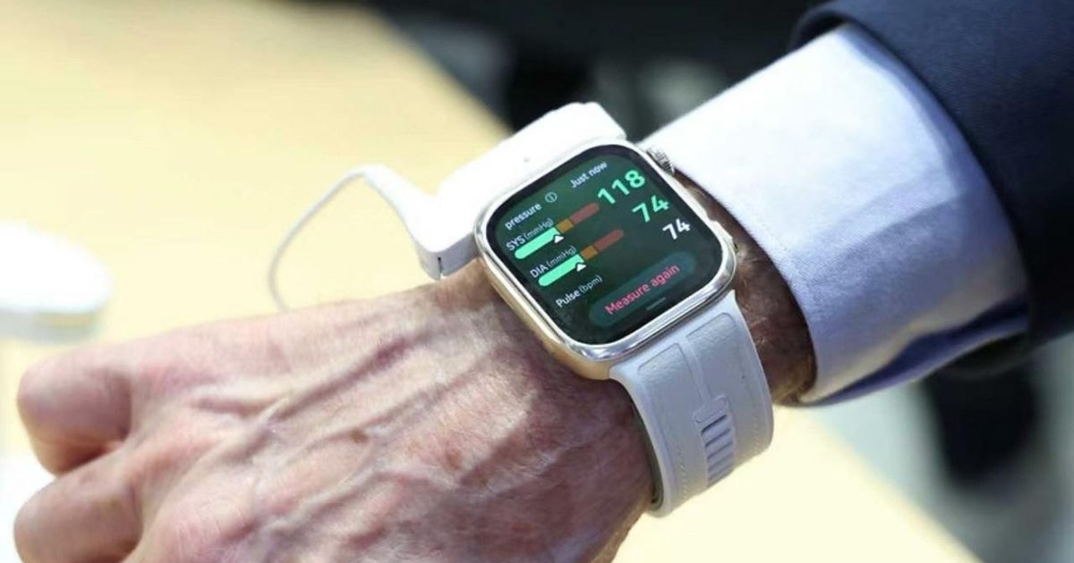 A smartwatch that measures real blood pressure level is around the corner, and it doesn’t look goofy