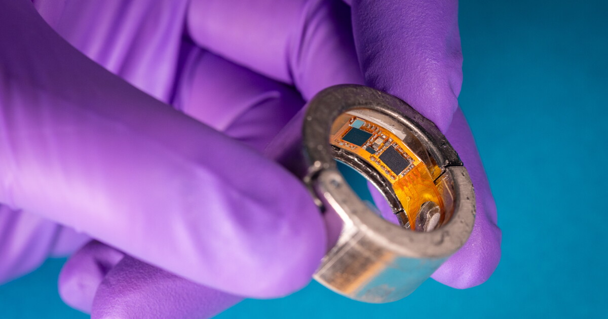 Smart ring reads your sweat to measure glucose, ketones, and more