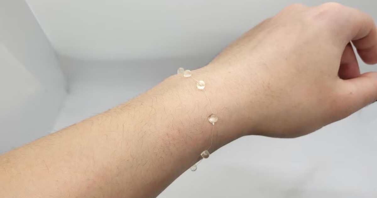 New electronic thread revolutionizes discreet wearable medical monitoring