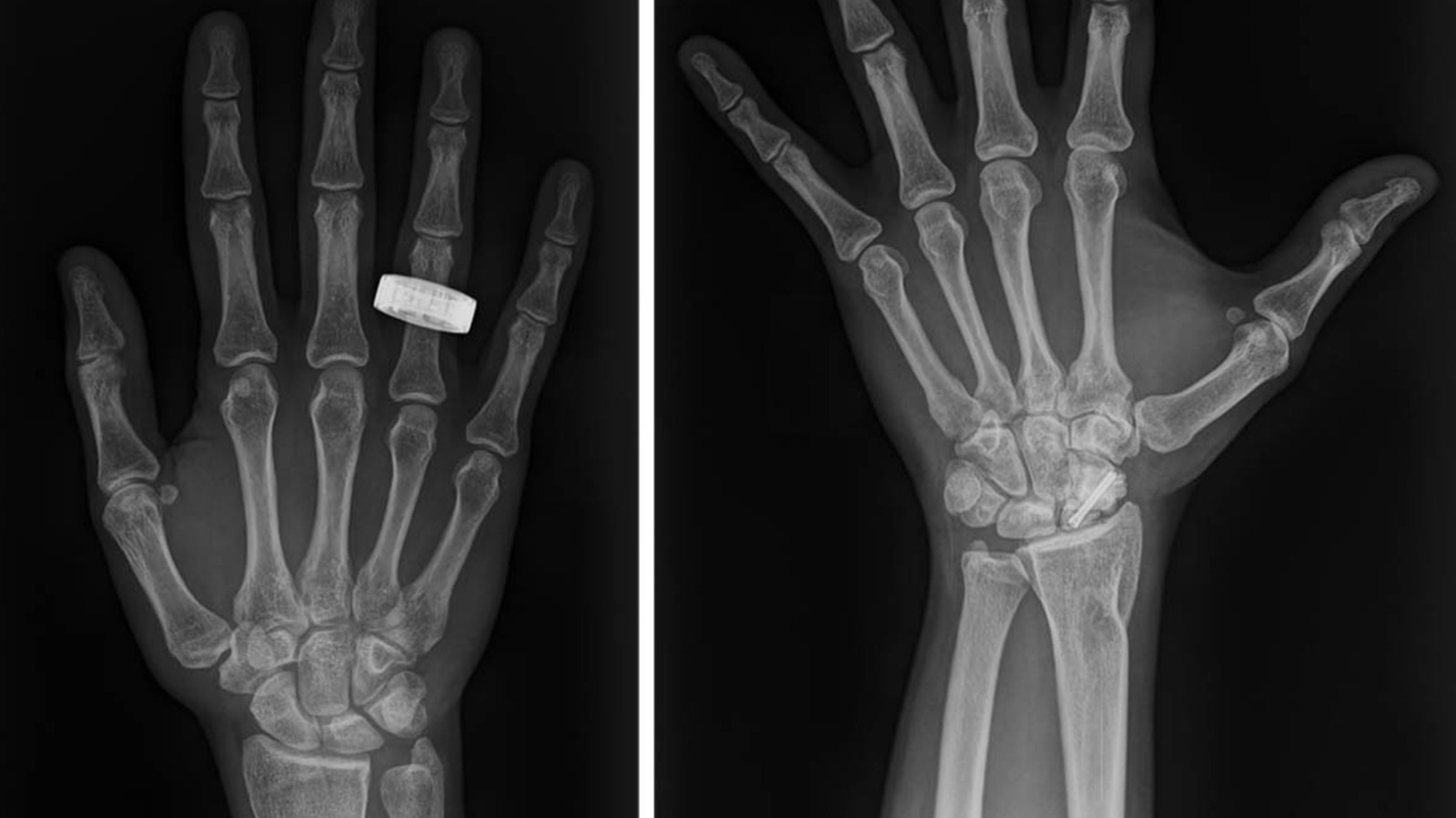 First-Ever Medical X-Rays In Space Could ‘Change The Game’ For Astronauts’ Health – SlashGear