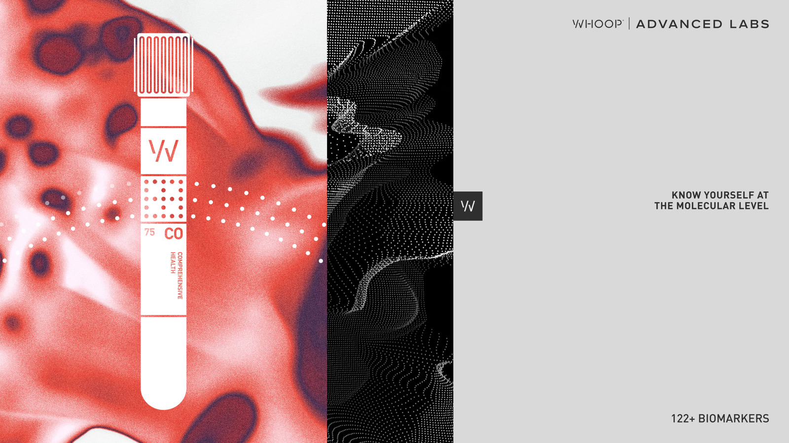Whoop’s Advanced Labs health screenings will no longer require a subscription – Engadget
