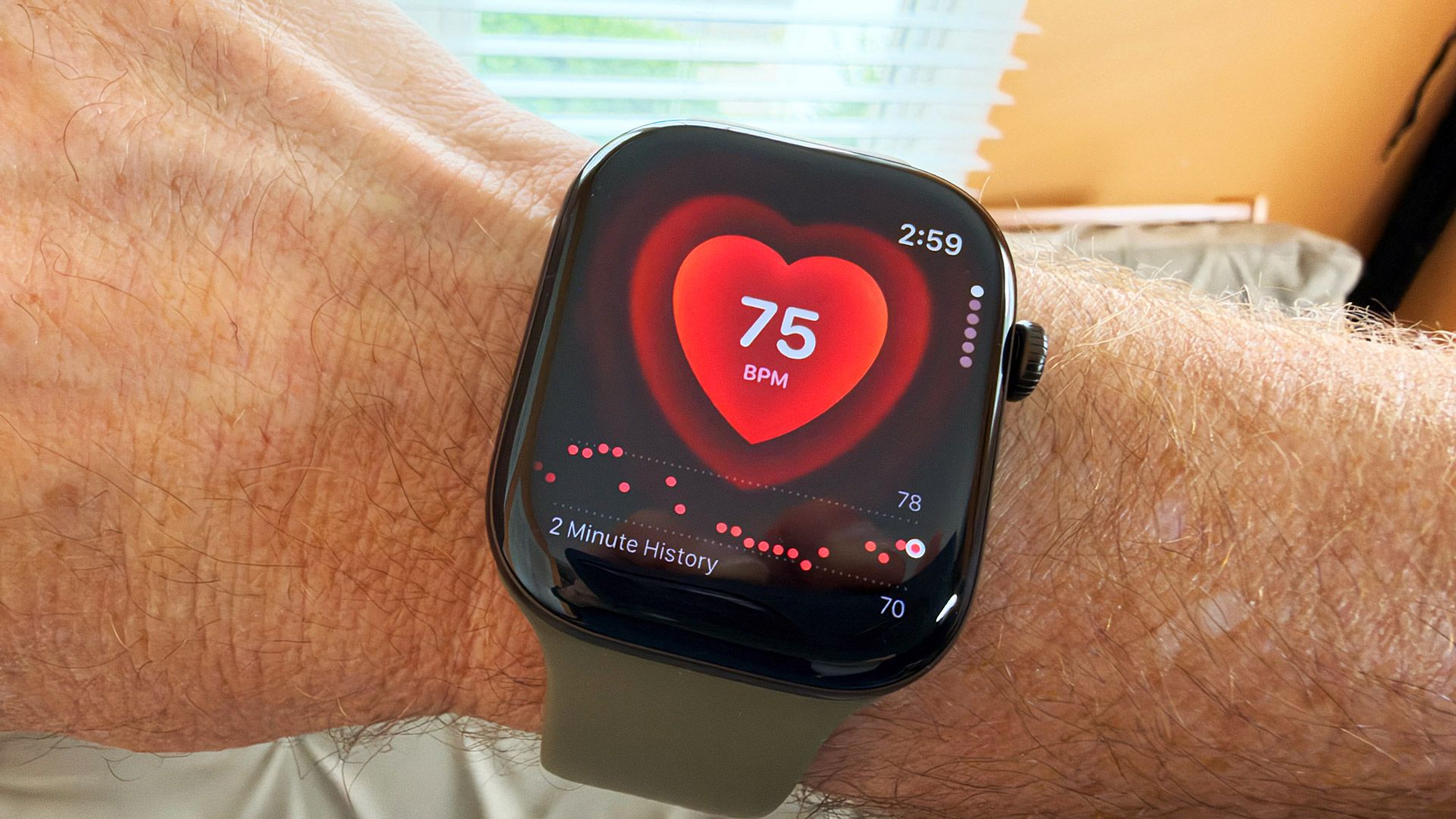 After 10 days with the Apple Watch Series 12, I’m disturbed by one ‘slightly off’ reading
