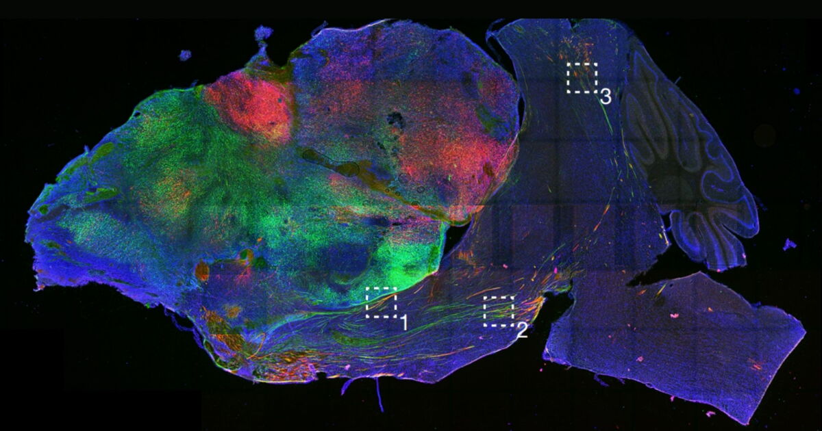 Hybrid human-mouse brain created in landmark lab experiment