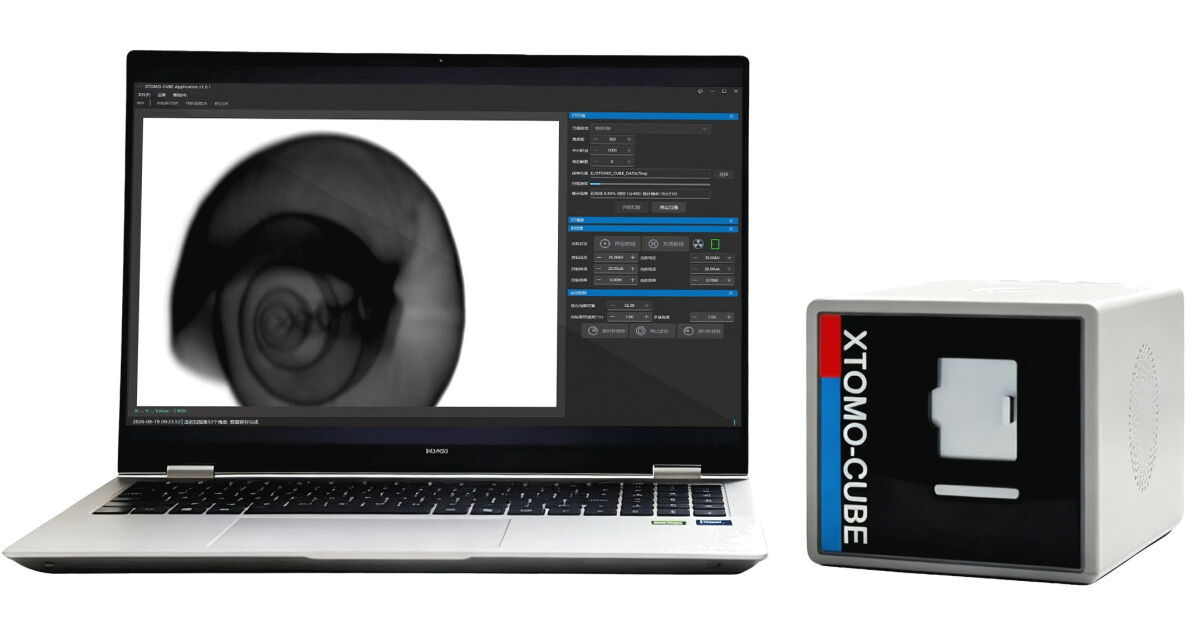 World’s smallest CT scanner fits in the palm of your hand