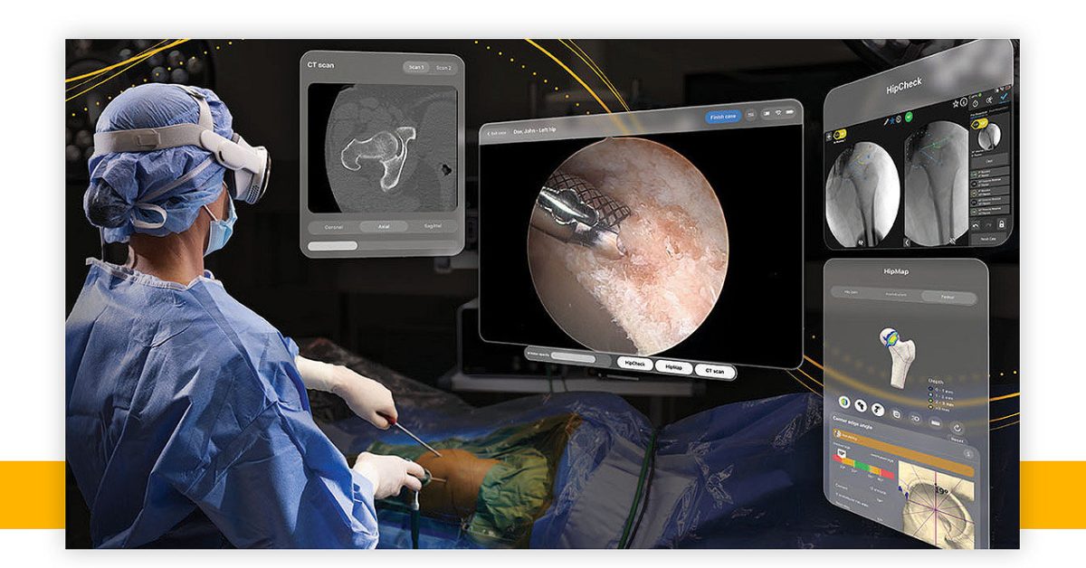 Apple Vision Pro was just used in a first-of-its-kind surgery – 9to5Mac